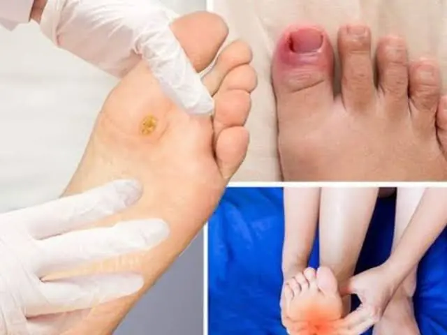 Recognize These 9 Early Warning Signs of Diabetes Before It's Too Late