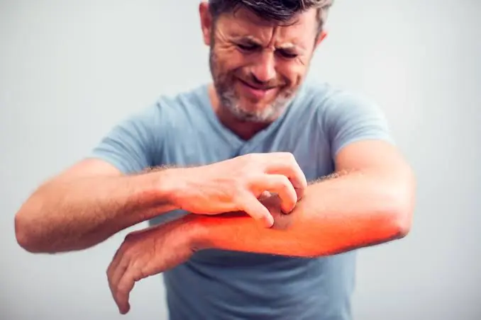 Itching Isn't Always Harmless—9 Types That May Point to an Underlying Problem