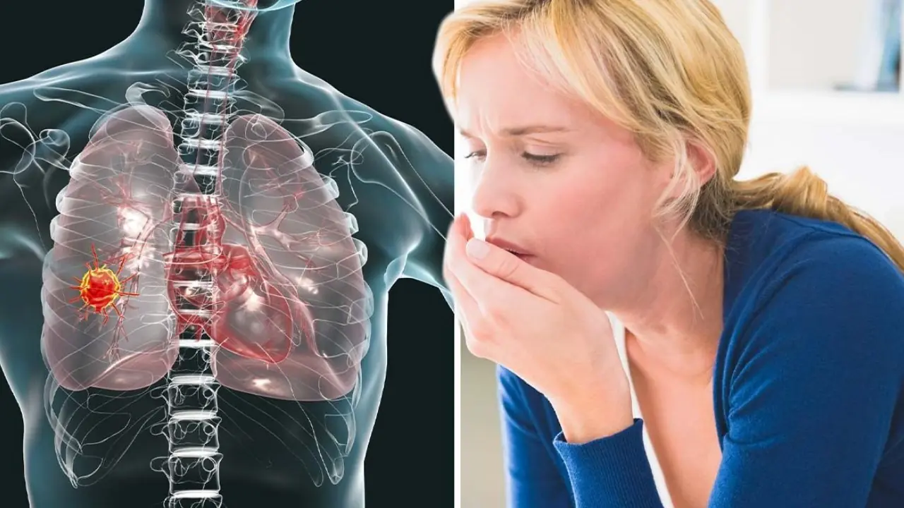 Early-Stage Lung Can,cer May Not Begin With a Cough: Watch for These 5 Common Warning Signs Instead