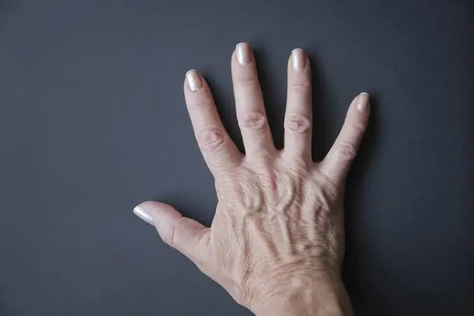 When veins trace clearly beneath the skin, it could be a sign that surprises many people