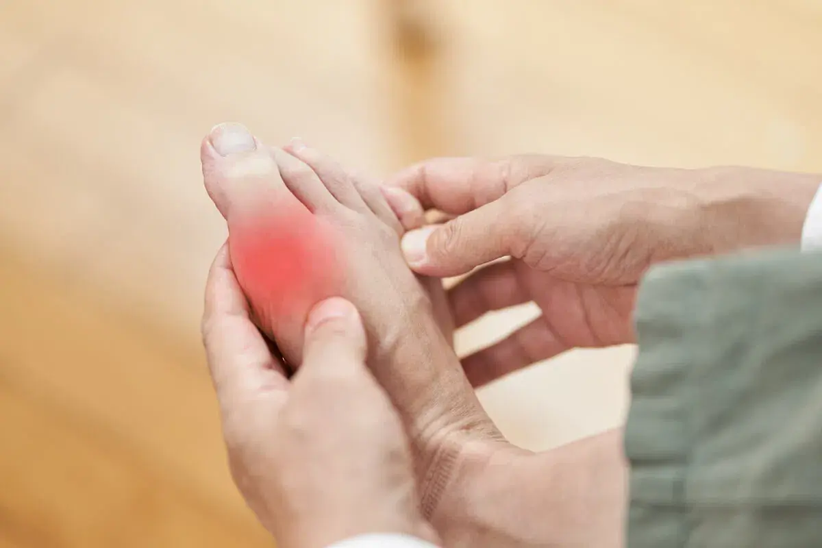 Certain Foods Can Raise Uric Acid Levels - Here's What People With Gout Should Know