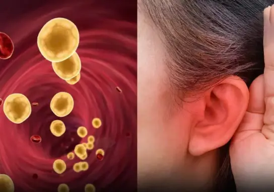 4 Subtle Clues on Your Body That Point to High Blo.o.d Fa.t