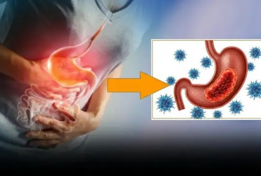 Warning signs of advanced sto.mach can.cer you should never ignore