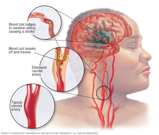 Your Body May Give You Early Clues—These 6 Nighttime Symptoms Could Be Important
