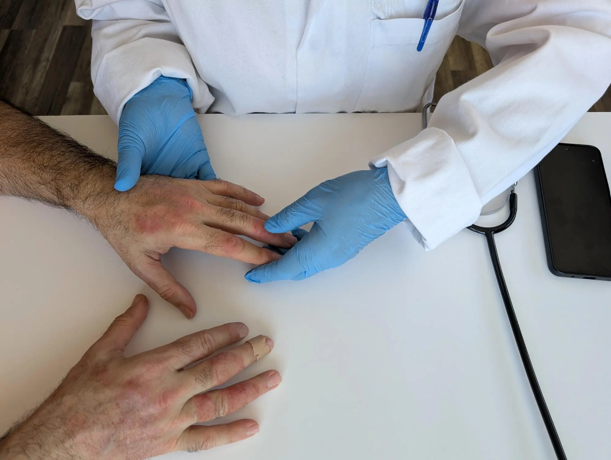 Doctors Warn: Don't Ignore Tiny Red Dots on Your Skin—They Could Be Your Body's Warning Signal