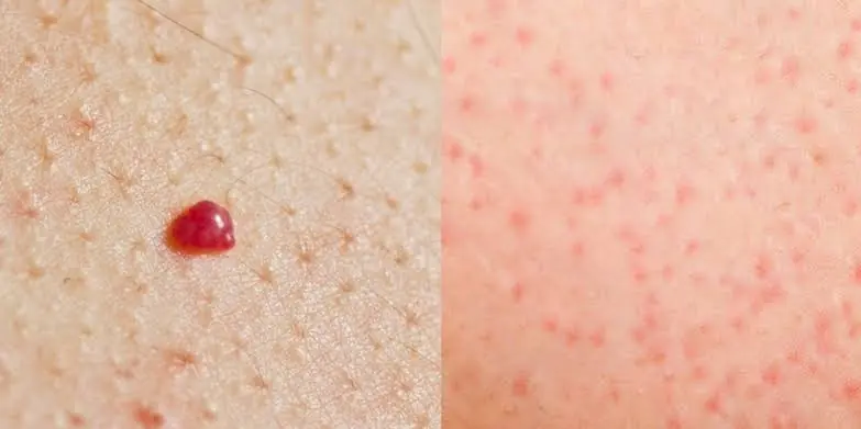 Red Spots on Your Skin Can Have Many Causes—Here's What to Know