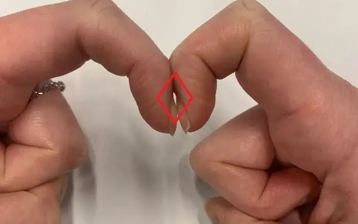 Many People Try This Simple Finger Test - Here's What It Actually Means