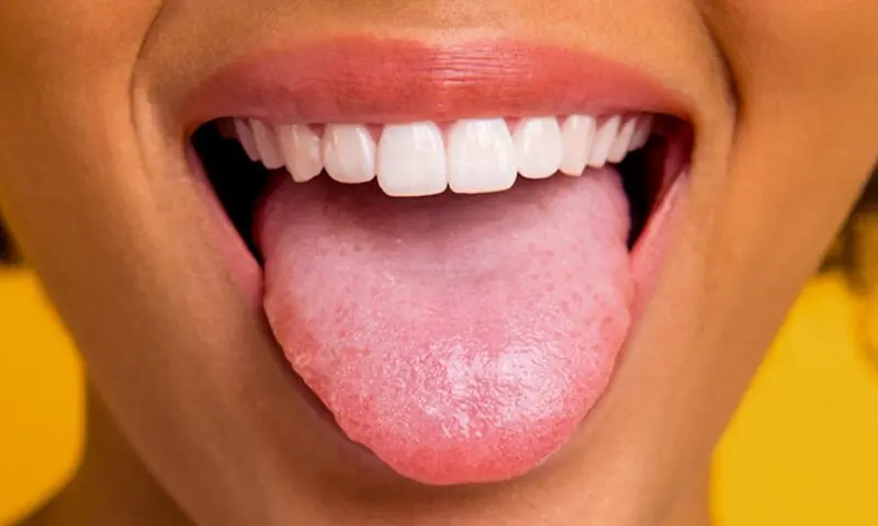 A White Tongue Can Have Many Causes - Here's What to Look For