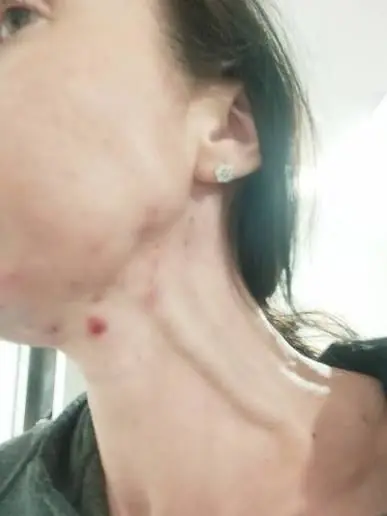 This Change in Your Neck Veins Could Be Worth Paying Attention To
