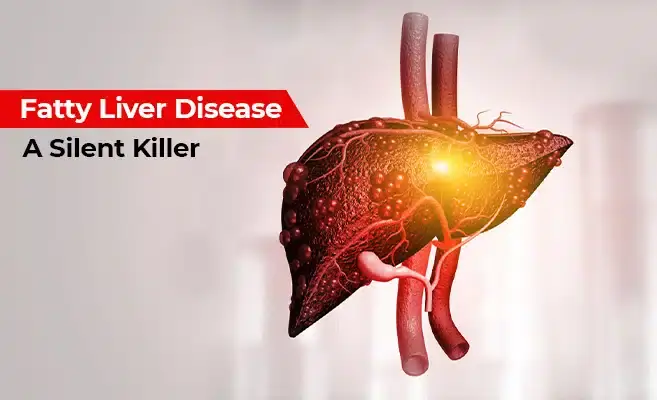 Fatty Liver Disease Can Develop Silently—Know the Symptoms Before It's Too Late