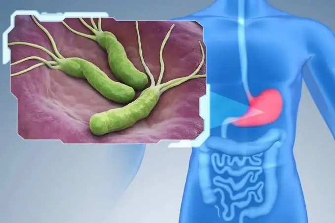 Beyond Spicy Food: 4 Things That May Increase Your Risk of Stomach Cancer