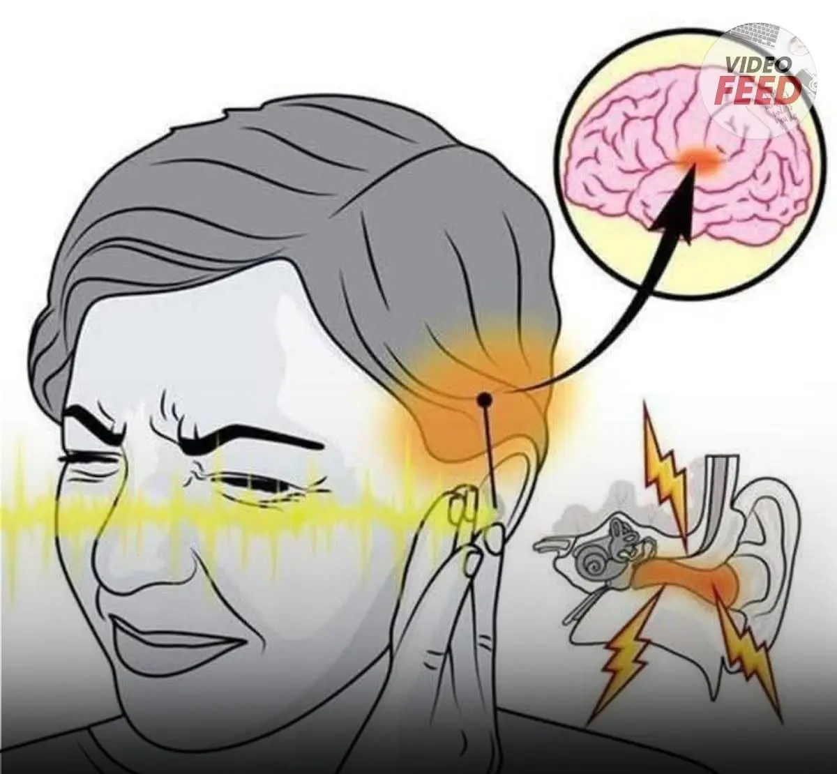 Doctors explain why some people hear ringing even when everything is quiet.