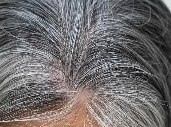 Can Gray Hair Be Reversed? Here’s What Science Really Says