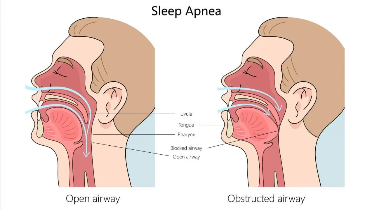 Excessive Saliva While Sleeping? It Could Be Your Body Asking for Help