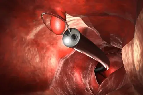 Your Doctor May Recommend a Colonoscopy—Here's Why It Matters