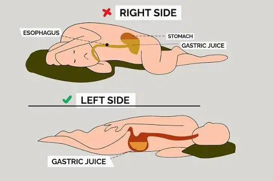 Most People Don't Think Twice About Sleeping on Their Right Side—Maybe They Should