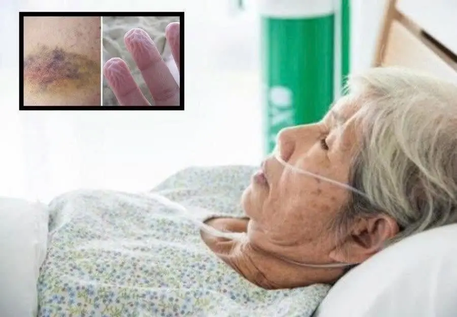The body rarely goes silent before the end — these 6 warning signs may appear up to a year in advanc