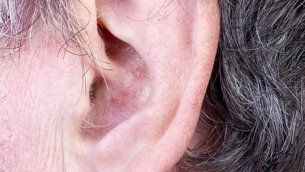 Ear Hair and Your Health: What Doctors Really Say About This Overlooked Body Sign
