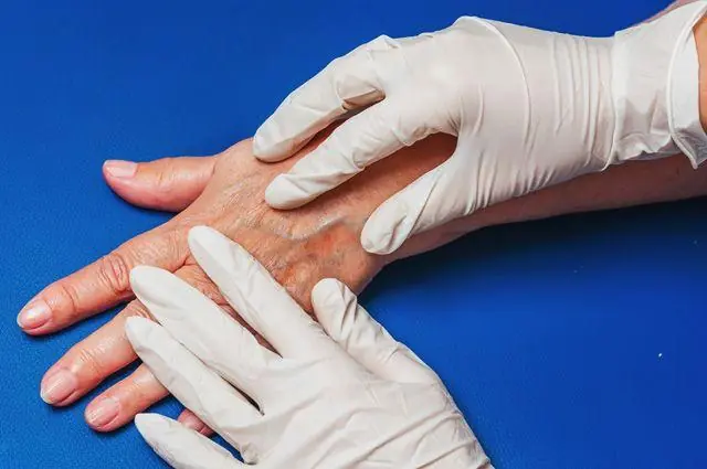 What Do Visible Veins on Your Hands Really Mean? Here's What Experts Say