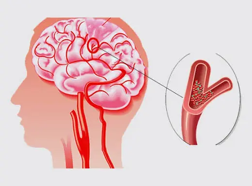 These Symptoms May Be Worth Paying Attention To