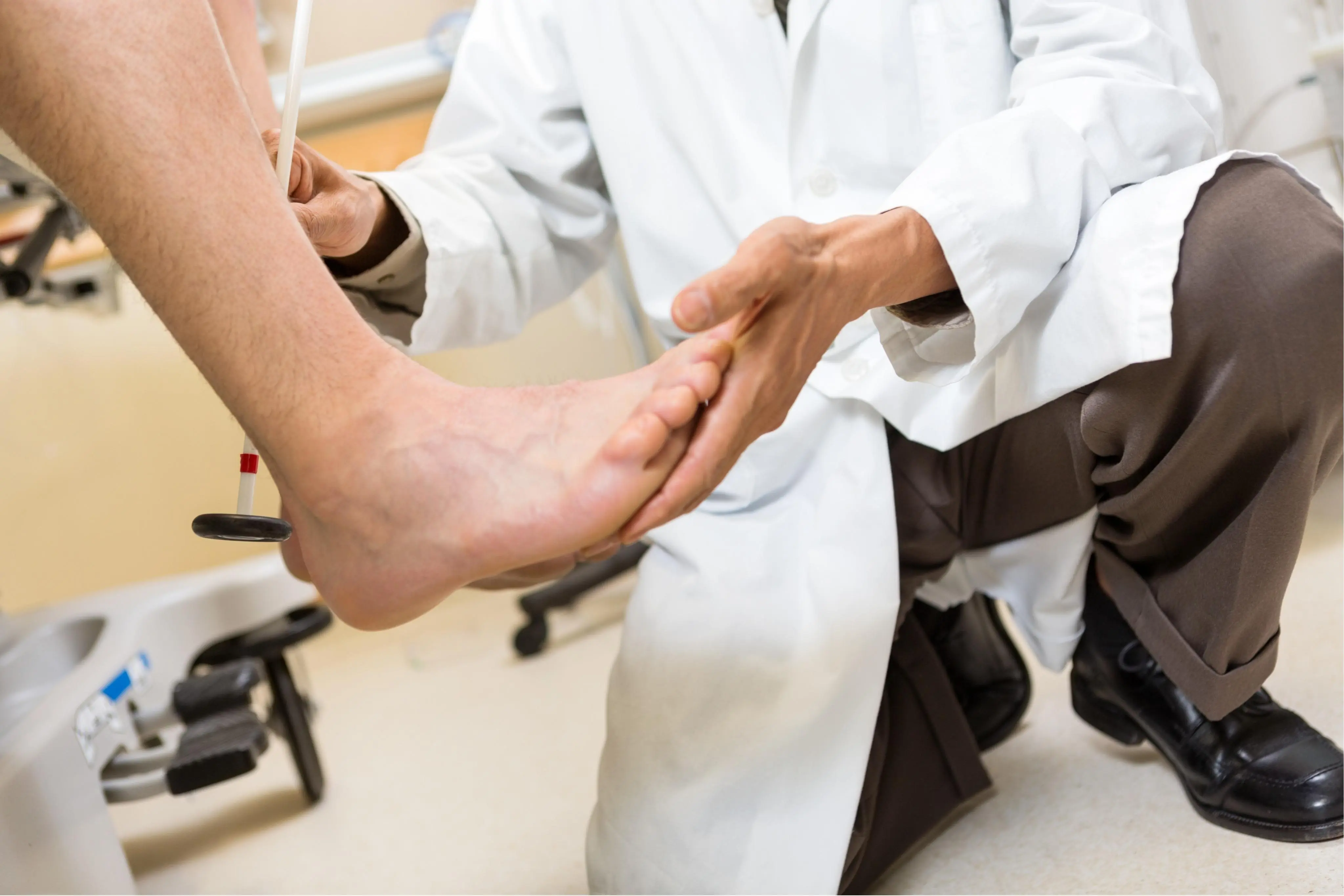 Warning Signs of Poor Blo.od Circulation in Your Legs and Feet That Could Signal Heart Problems