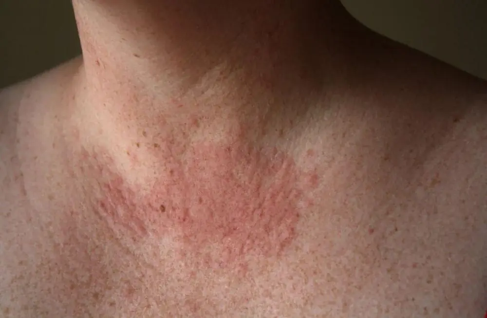 If It's Red, Itchy, and Smelly: Your Body May Be Trying to Warn You of These Hidden Health Problems