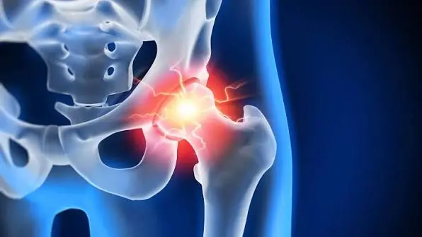 The Hidden Causes of Hip Pain That Doctors Want You to Know