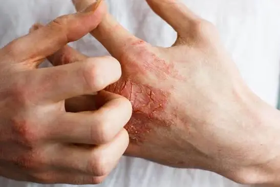 Not All Itching Is Harmless—These 9 Signs Could Point to a Health Problem