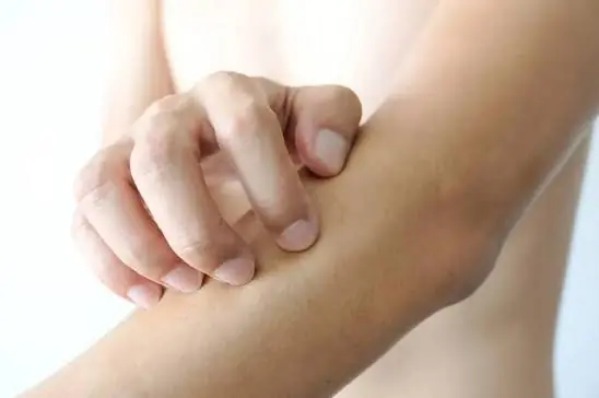 It Started With Allergy-Like Symptoms—Then Doctors Made an Unexpected Discovery