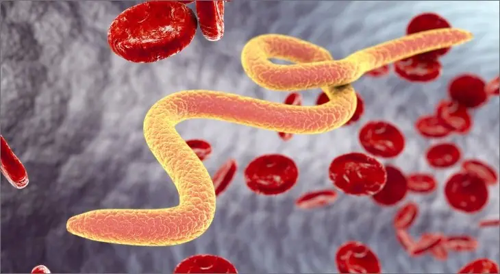 These 4 Everyday Foods Could Increase Your Risk of Foodborne Parasites