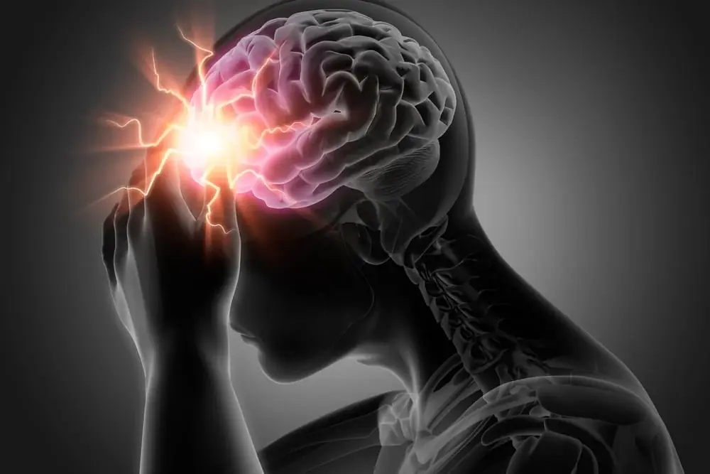 A Stroke Doesn't Always Happen Without Warning—Here's What Experts Want You to Know