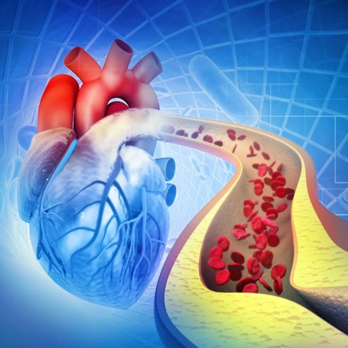 Foods That May Help Keep Your Arteries Healthy and Your Heart Strong