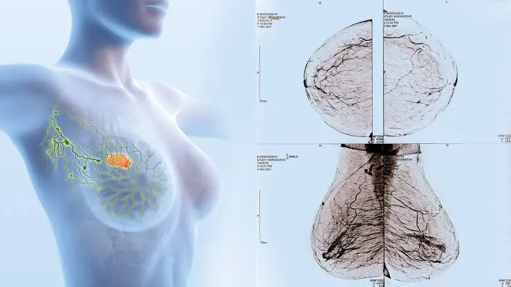 These 10 Changes Could Be Signs of Breast Cancer — Here's What to Watch For