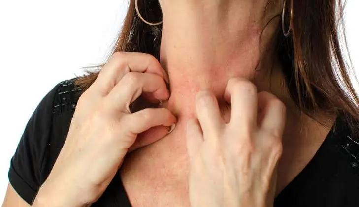 If You Have These 9 Types of Itching, Your Body May Be Trying to Tell You Something