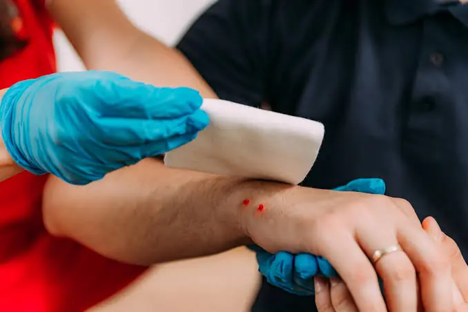 Snake Bite? Here's the Emergency Response You Need to Know