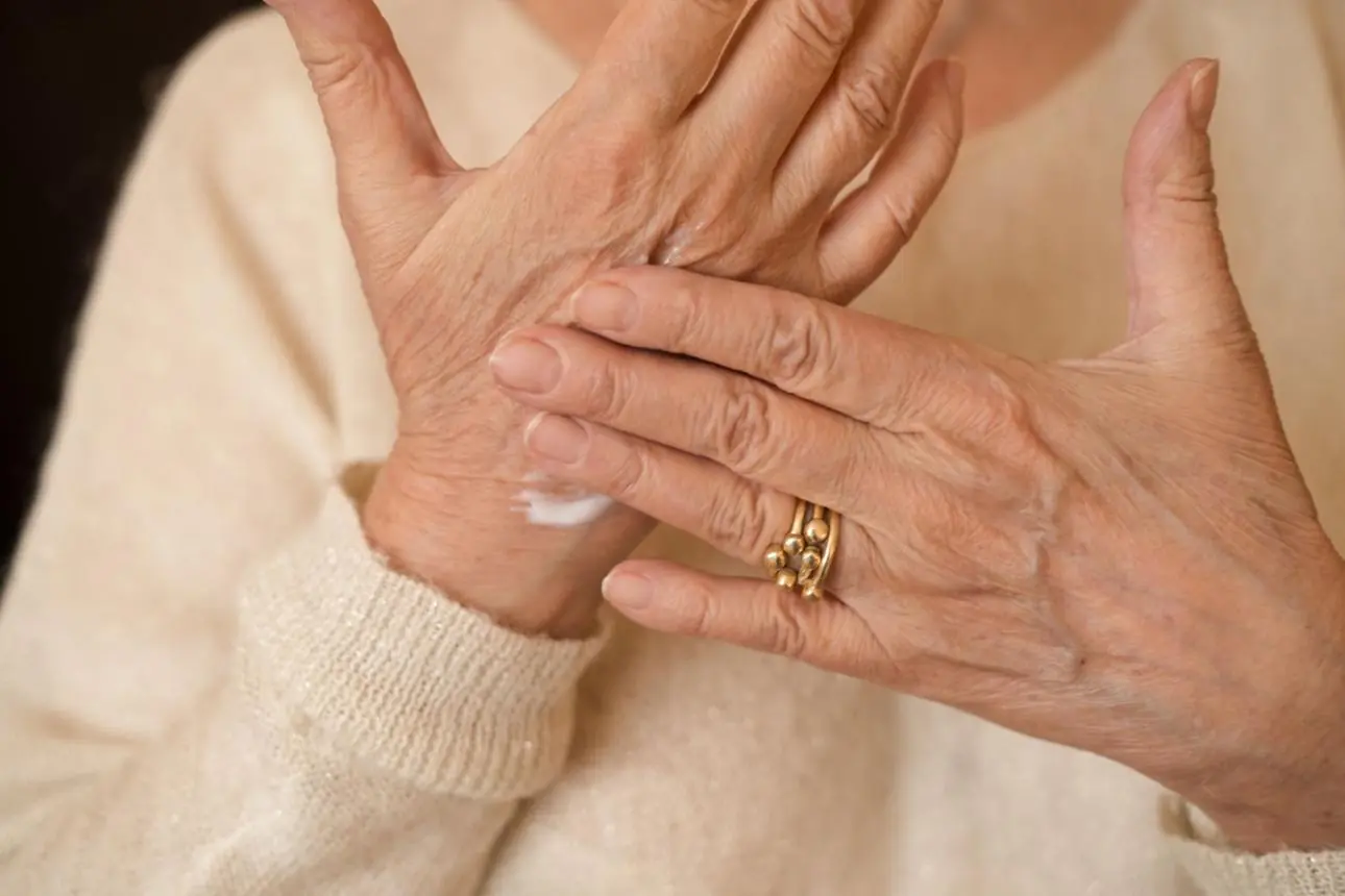 Age Spots on Your Hands: What They Mean and When You Should Pay Attention