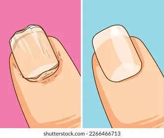 If Your Nails Keep Breaking, Your Body May Be Missing Something Important