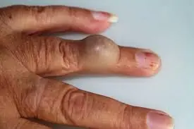 If You've Noticed This Lump, Your Daily Habits May Be Worth a Closer Look