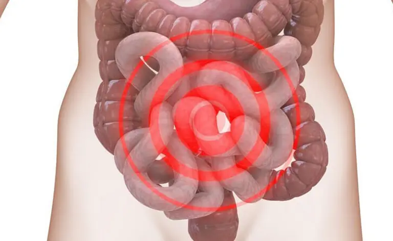 Early Detection Matters: 6 Colon Health Warning Signs to Watch For