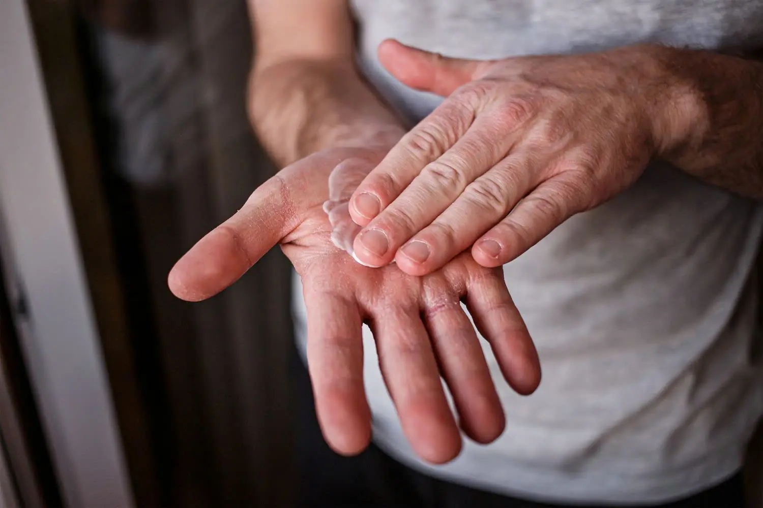 Dry, Cracked Skin: Common Causes and Simple Ways to Heal It Naturally