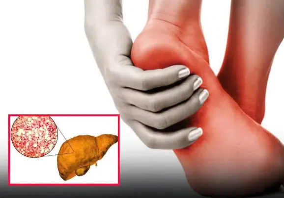 Doctor shares what it means if you always need to poo immediately after you eat