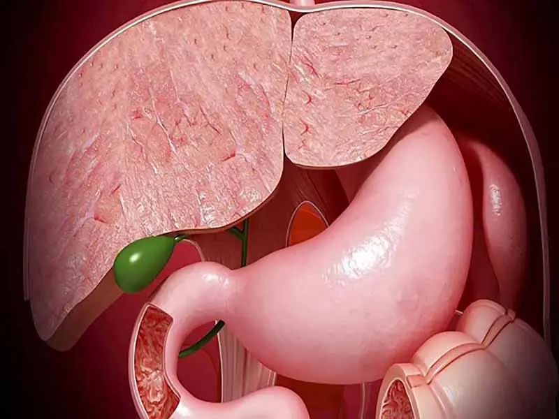 Life After Gallbladder Removal: Common Changes You Should Know About