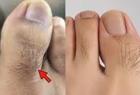 Many Women Ignore Toe Hair—But It Can Sometimes Reflect Your Health