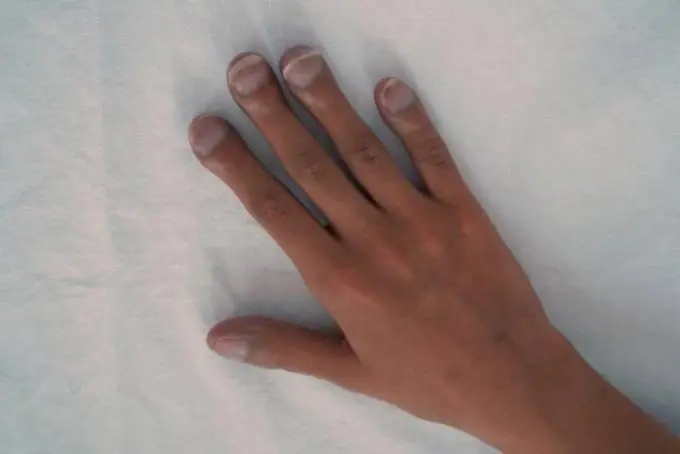 Your Hands Can Sometimes Reflect Changes in Lung Health - Here's What You Should Know
