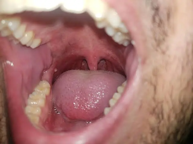 If You Notice These Changes in Your Mouth, It May Be Time to Pay Attention
