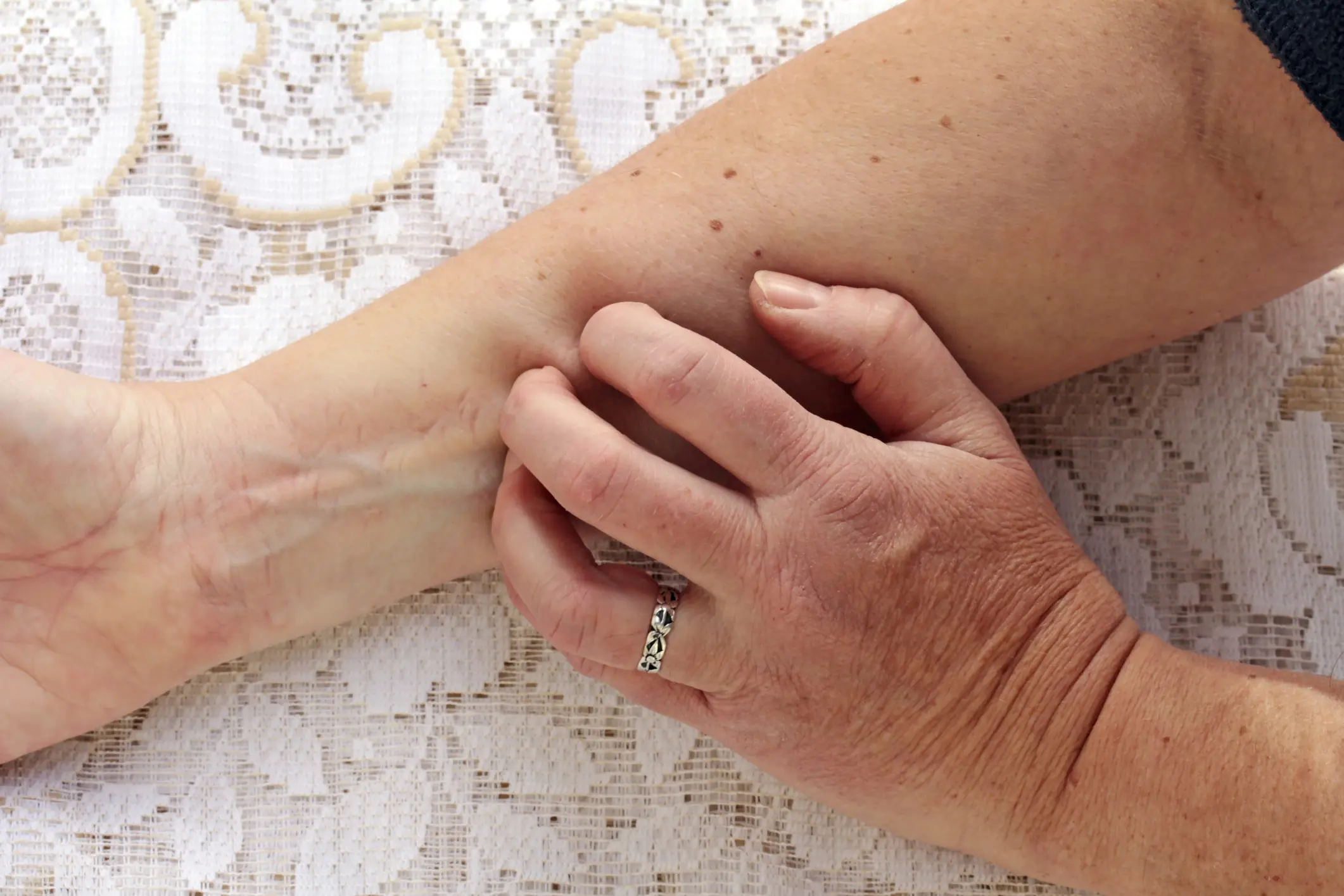 These 9 Itching Symptoms Might Reveal More About Your Health Than You Think