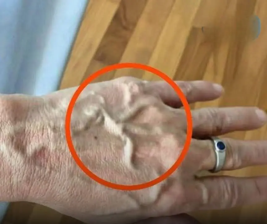 If you have visible veins it means you are..