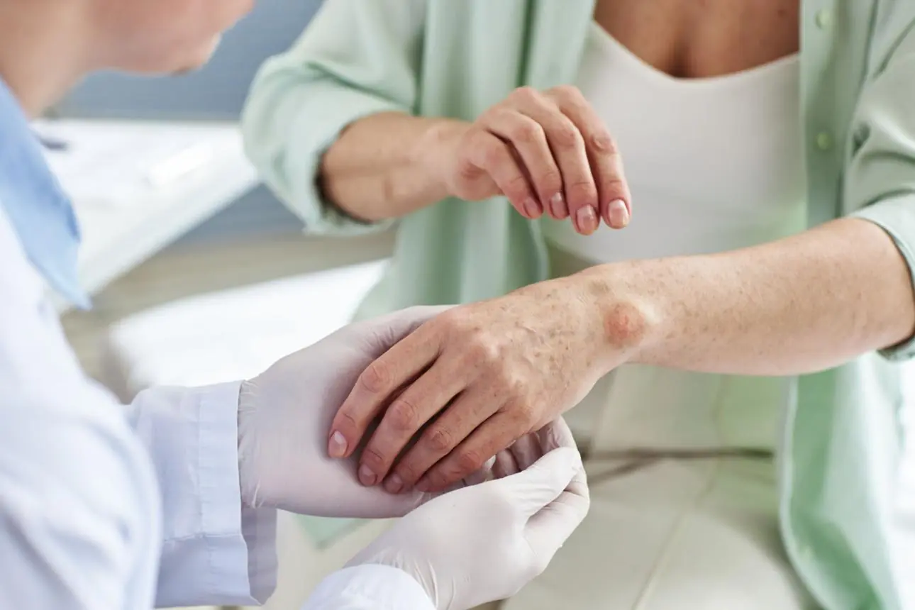 Tiny Red Dots on Your Skin? Here's What They Could Mean—and When to See a Doctor