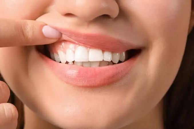 10 Simple Ways to Protect Your Teeth and Keep Your Smile Healthy