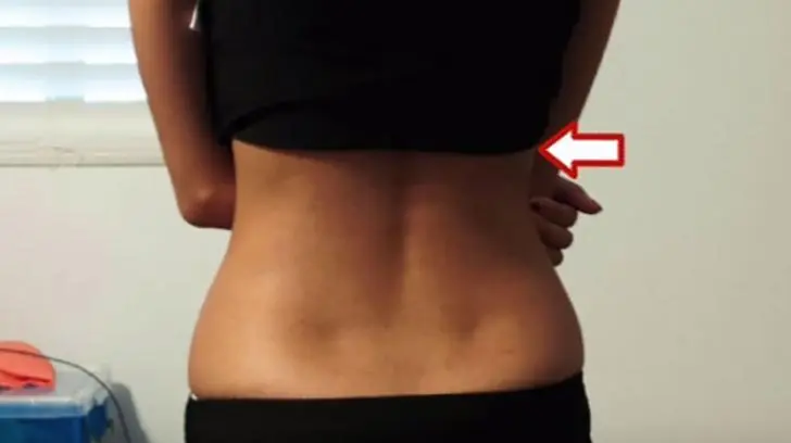 If You Have These Two “Dimples” on Your Lower Back, Here’s What They Actually Mean